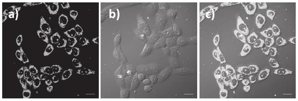 An RNA fluorescent probe that rapidly differentiates cancer from normal tissue using nucleolus morphological changes