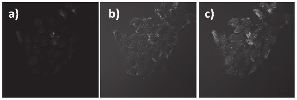 An RNA fluorescent probe that rapidly differentiates cancer from normal tissue using nucleolus morphological changes