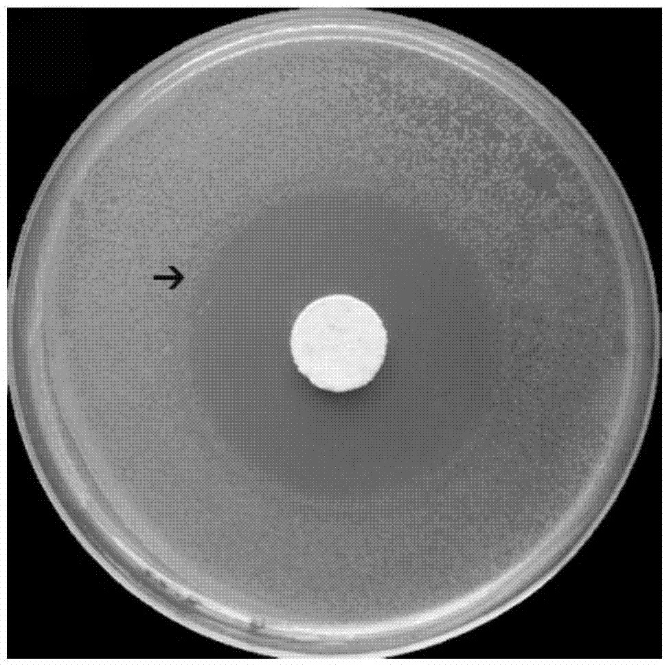 An injectable-porous-drug-loaded polymethyl methacrylate-based composite scaffold bone graft material and its preparation method