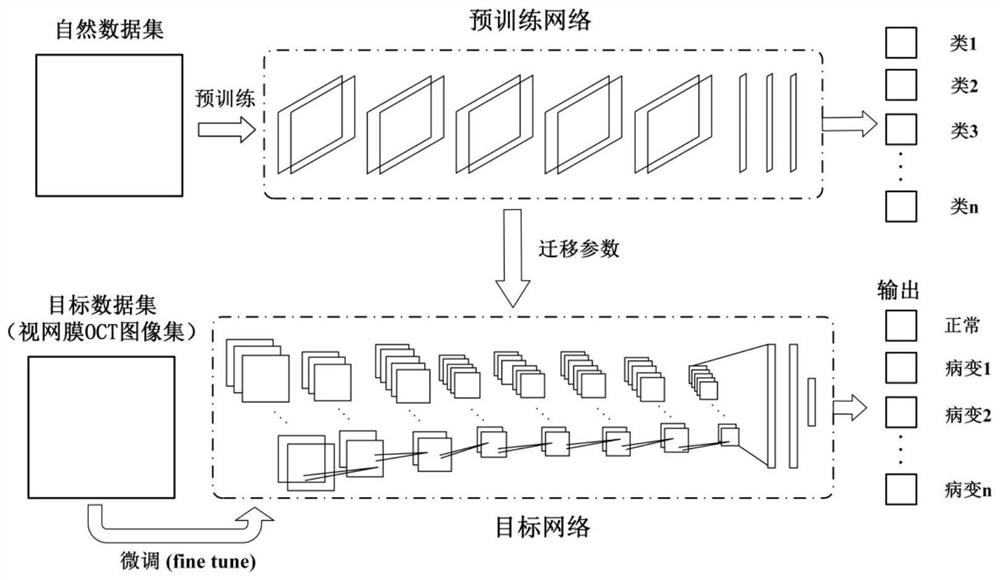 Optical coherence tomography image retinopathy intelligent detection system and detection method