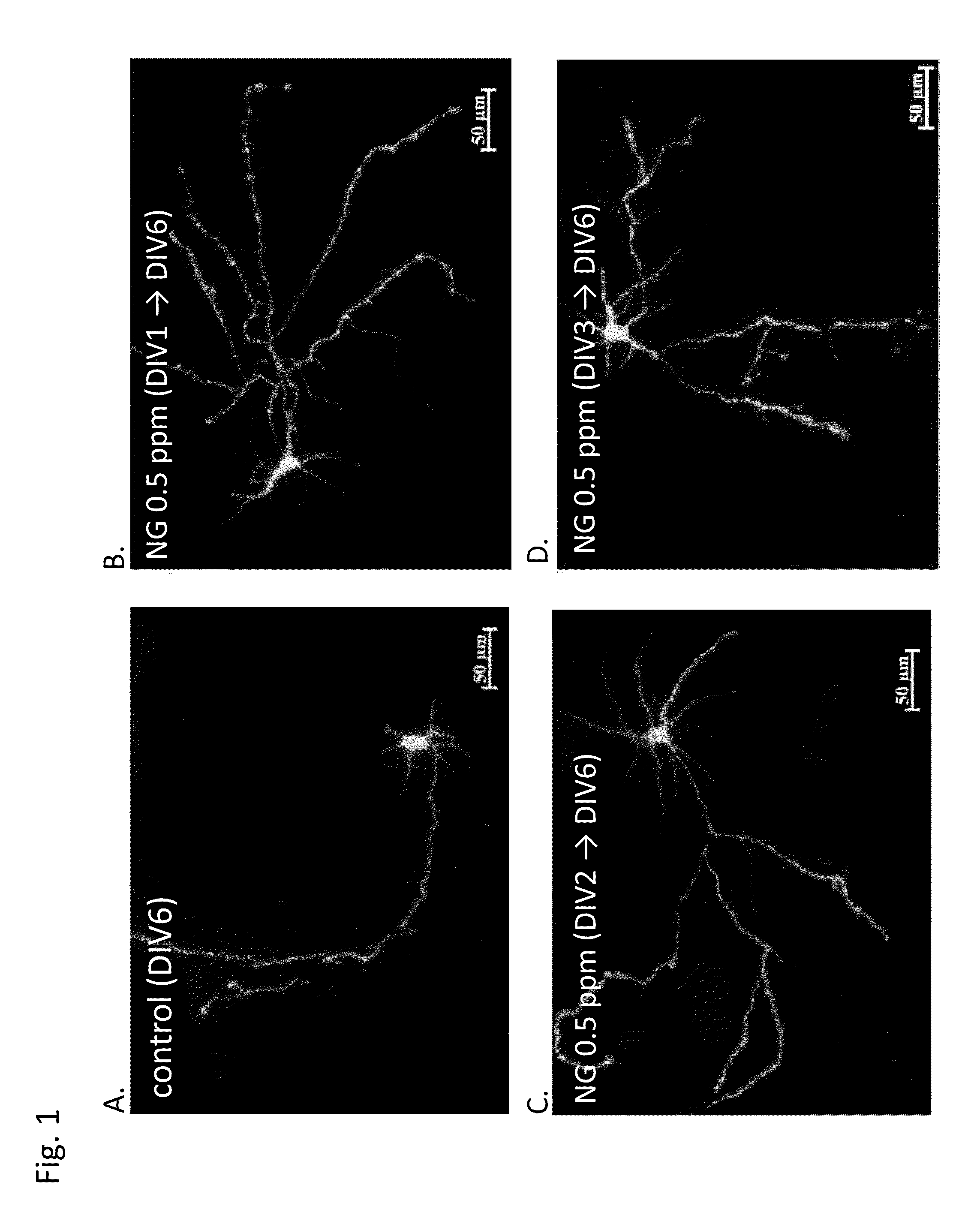 Transcranial burst electrostimulation apparatus and its applications