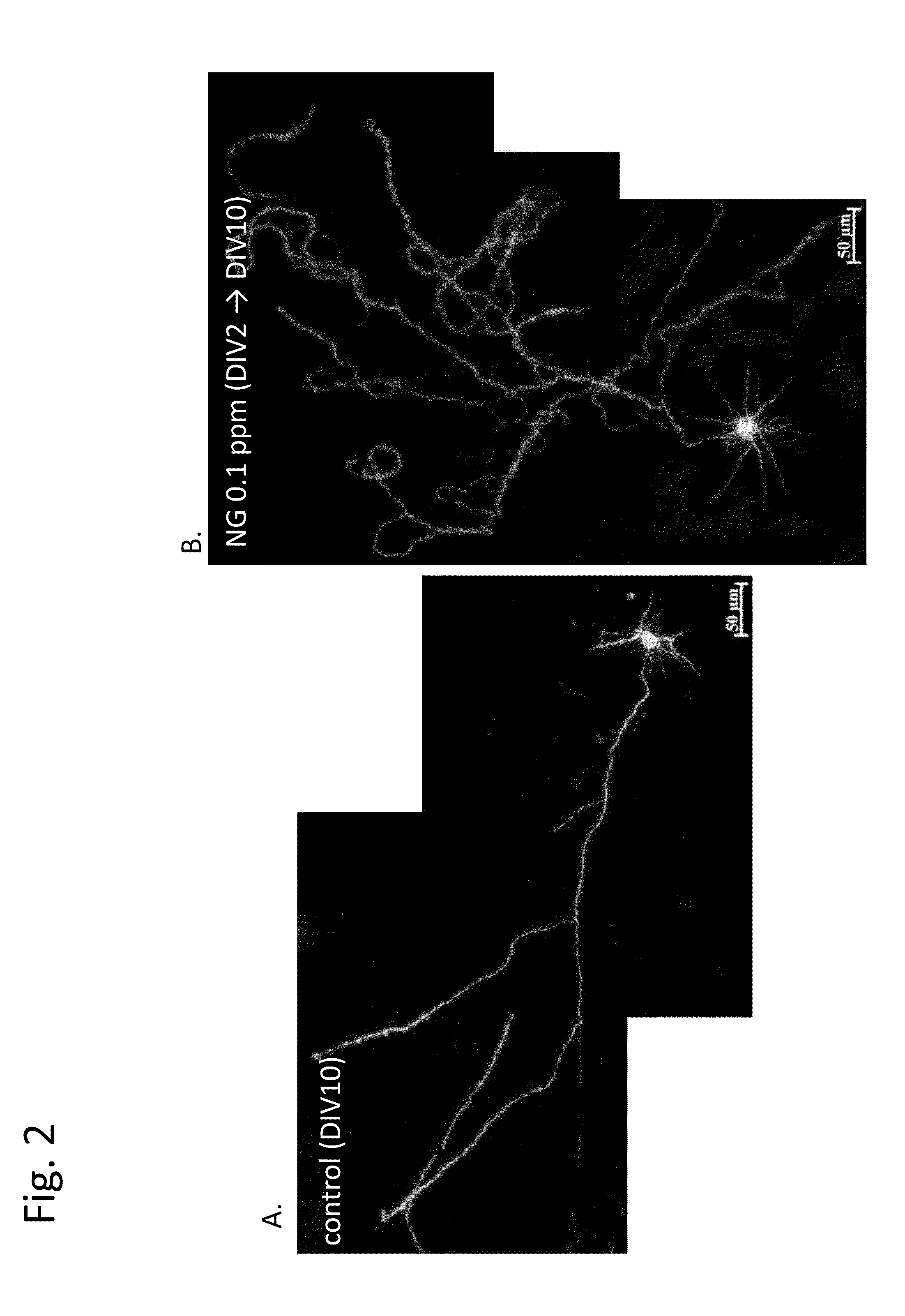 Transcranial burst electrostimulation apparatus and its applications