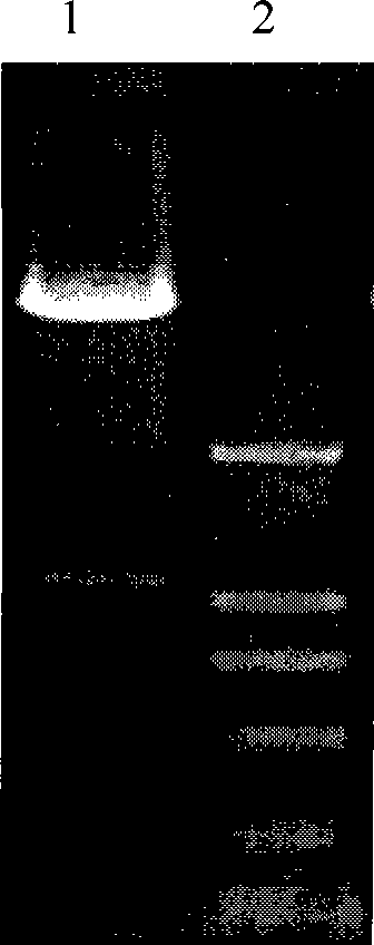 Fusion immunotoxin B-L-Vpr genes, and cloning and heterologous expression methods