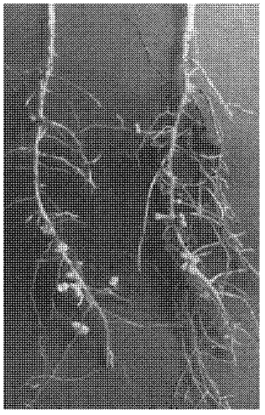 Rhizobium strain and application thereof