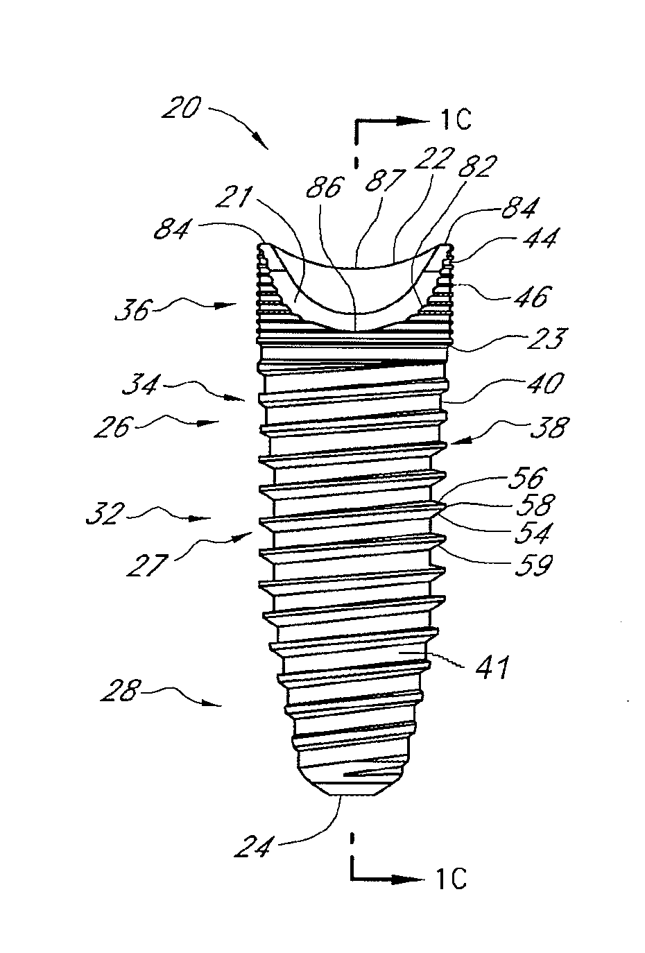 Asymmetrical dental implant