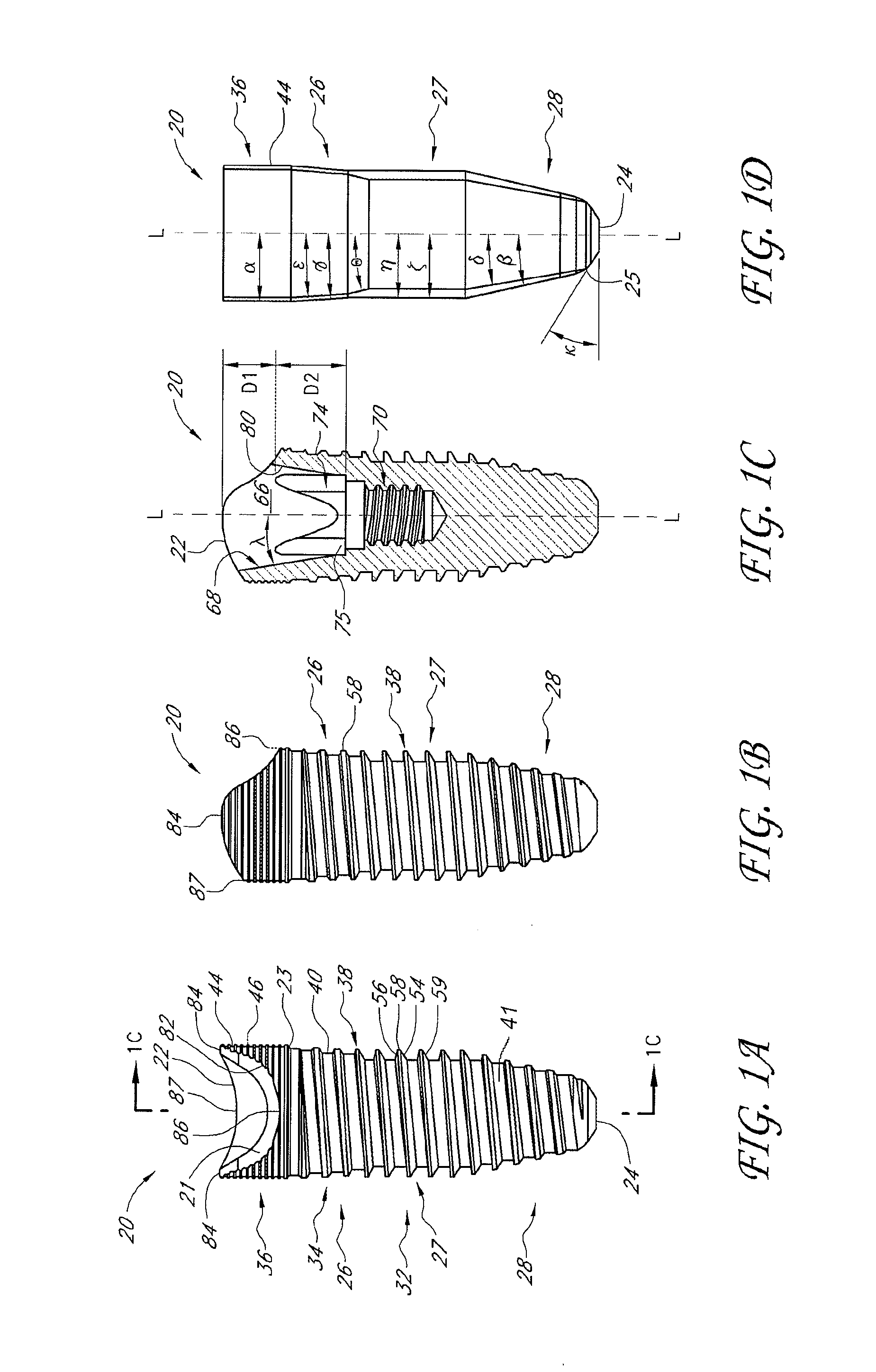 Asymmetrical dental implant