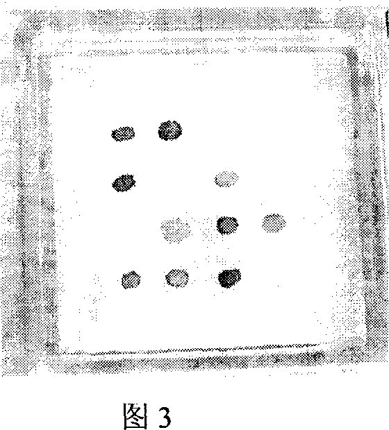 Gene chip for detecting several kinds of common pathogenic bacteria and its prepn process and kit