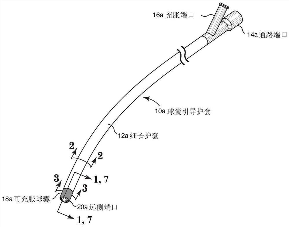 Internal carotid artery thrombectomy devices and methods