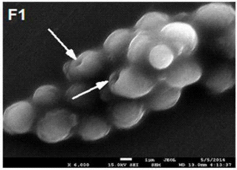 Quick preparation method for candida albicans specimen for field emission scanning electron microscope