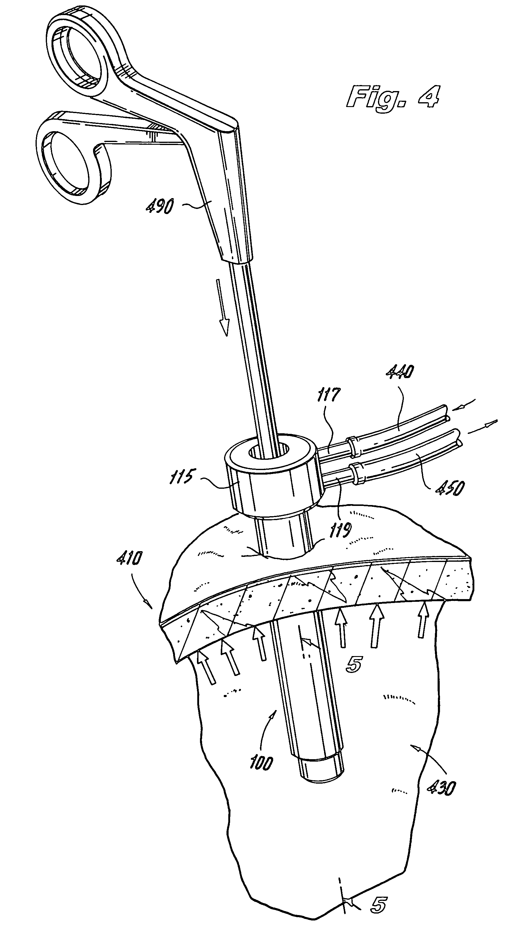 Trocar assembly with pneumatic sealing