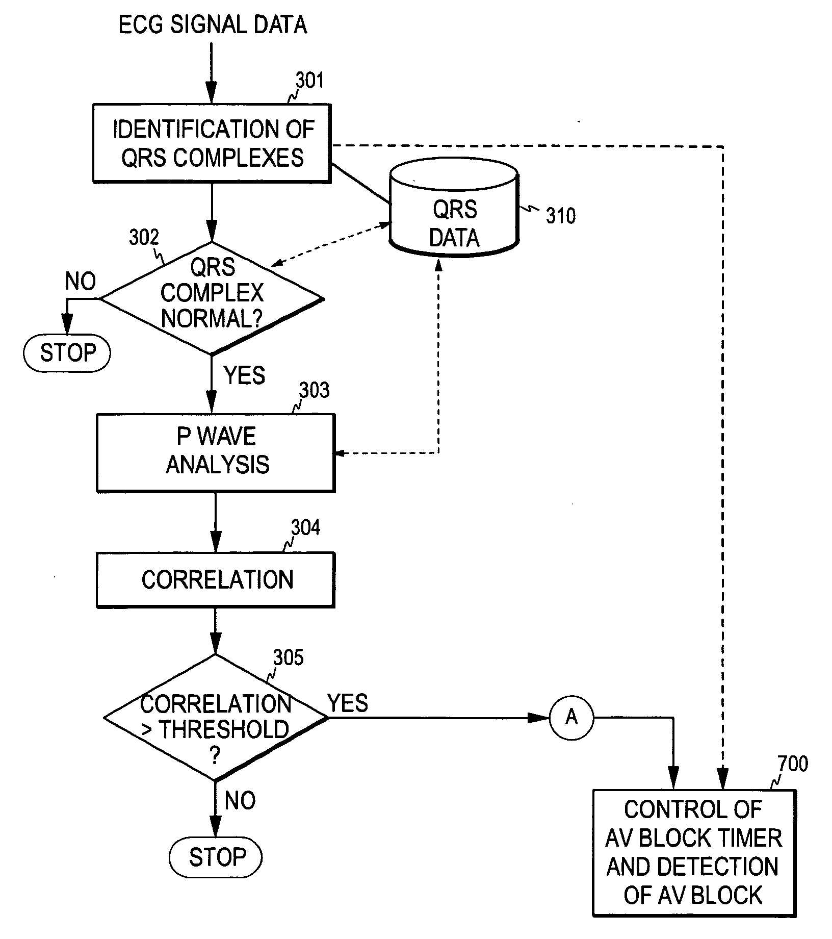 Monitoring of atrial activation