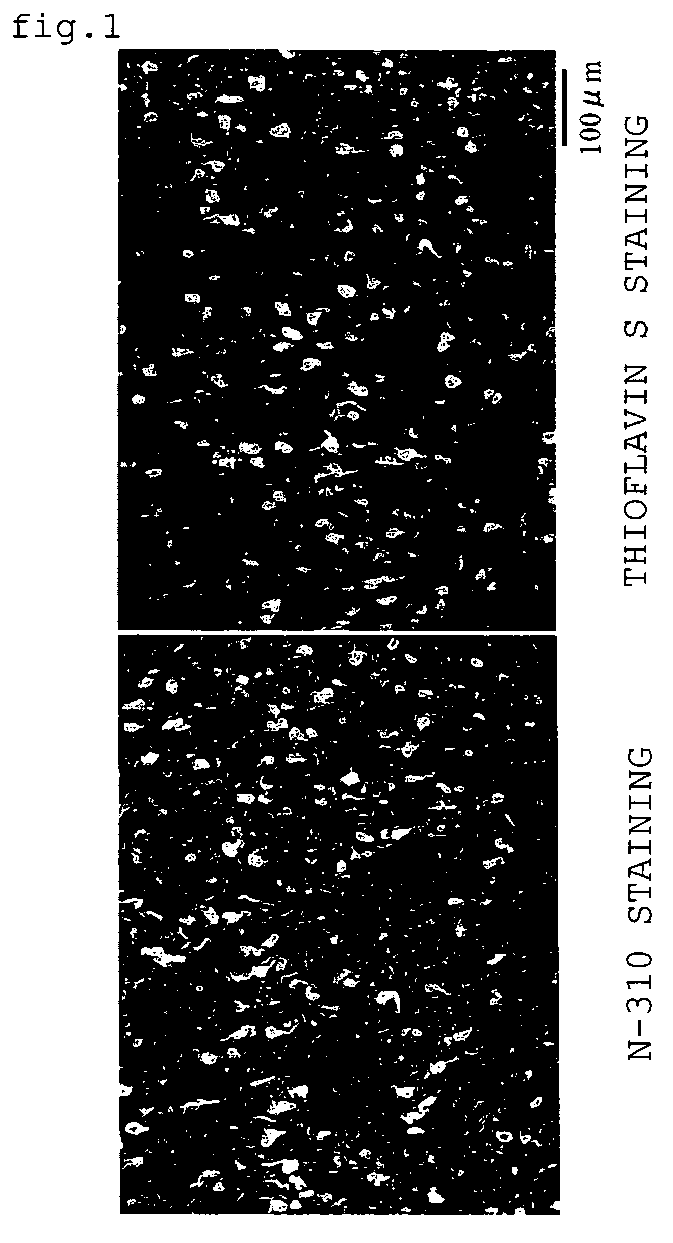 Quinoline derivative as diagnostic probe for disease with tau protein accumulation