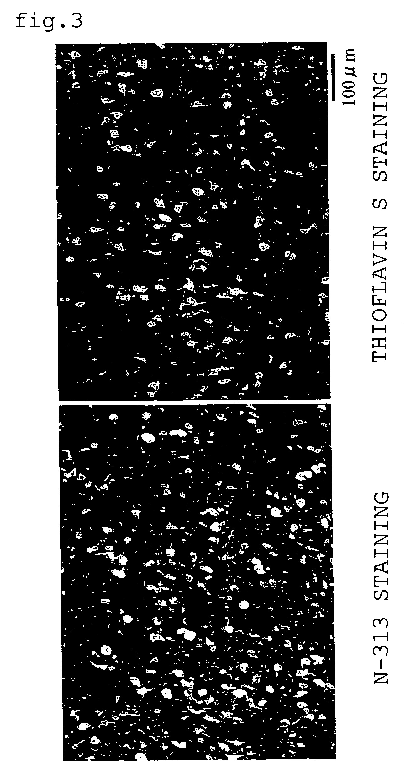 Quinoline derivative as diagnostic probe for disease with tau protein accumulation