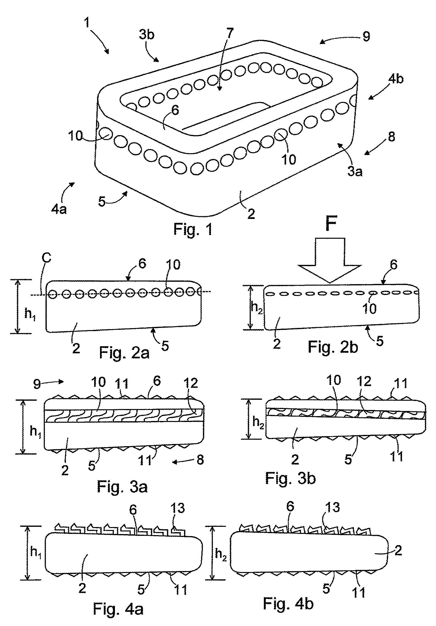 Surgical implant