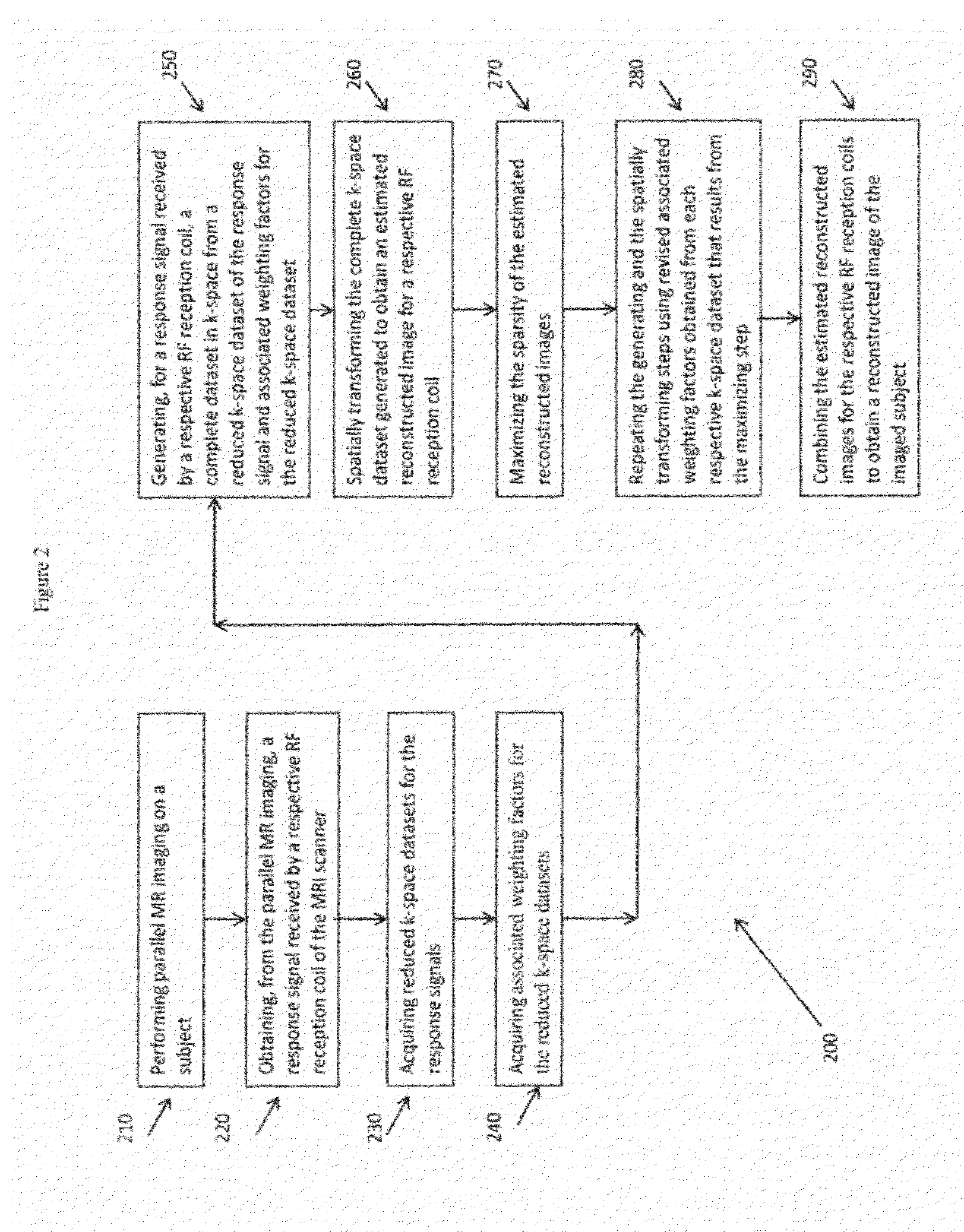 System for Accelerated MR Image Reconstruction