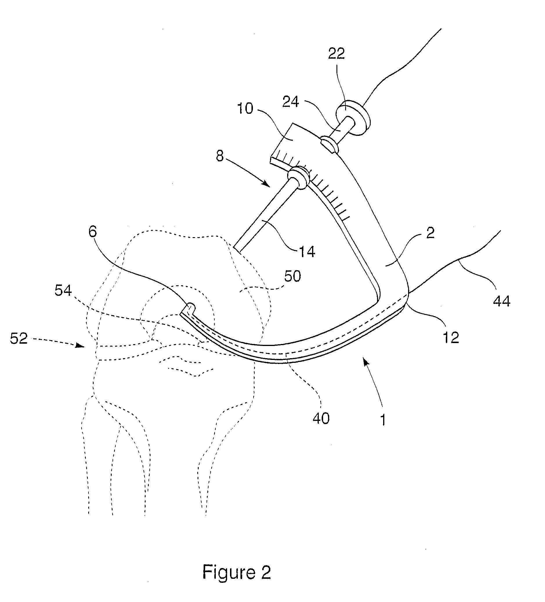  surgical drill aimer