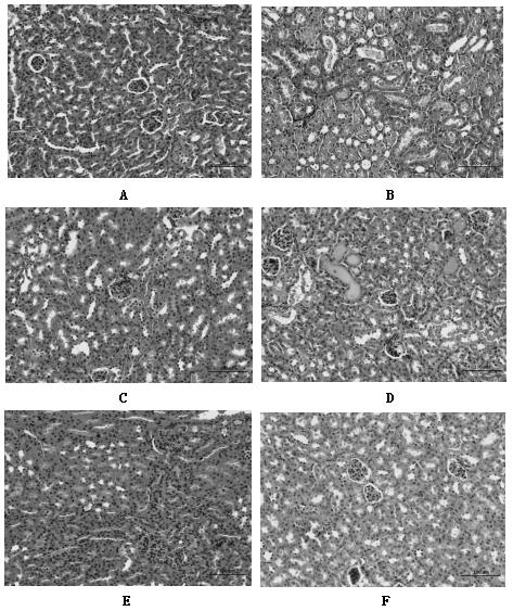 Preparation method for traditional Chinese medicine extract for treating sexual dysfunctions and application