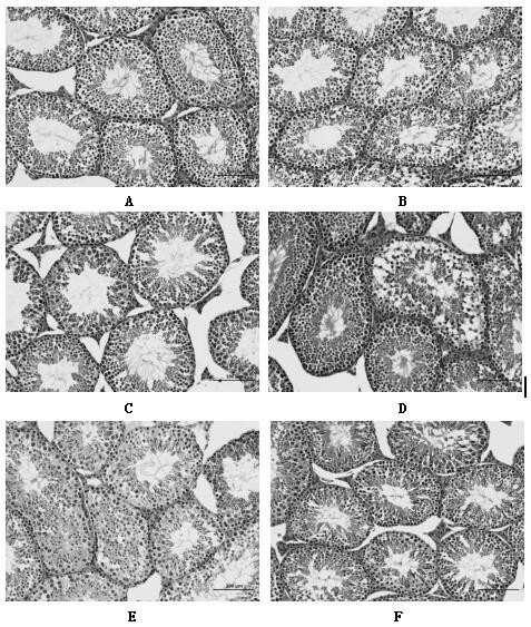 Preparation method for traditional Chinese medicine extract for treating sexual dysfunctions and application