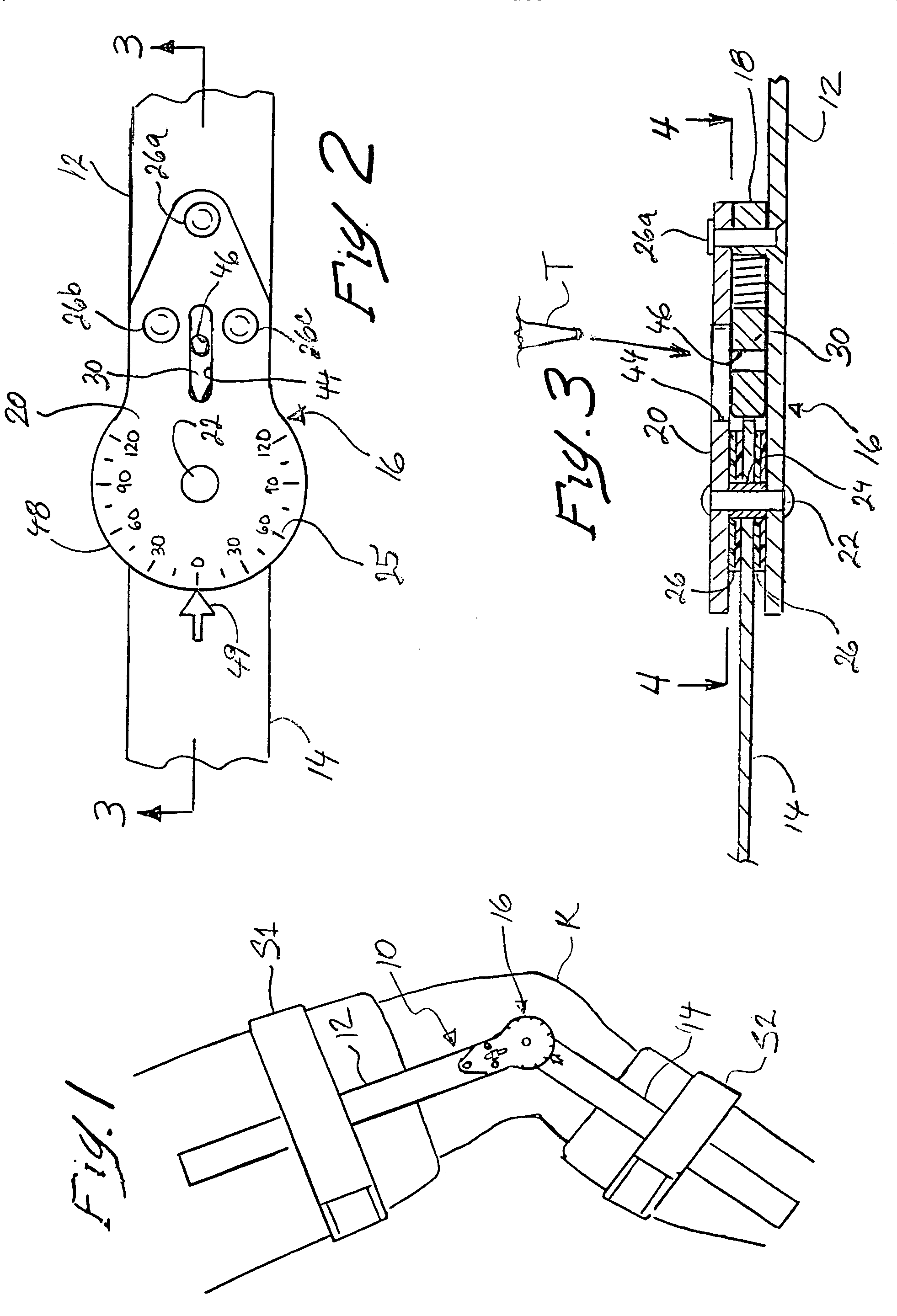 Adjustable hinges for orthopedic splints