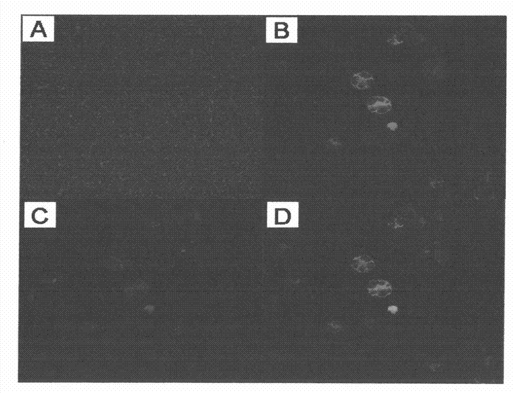 Tumor chemotherapeutic medicinal preparation and preparation method thereof