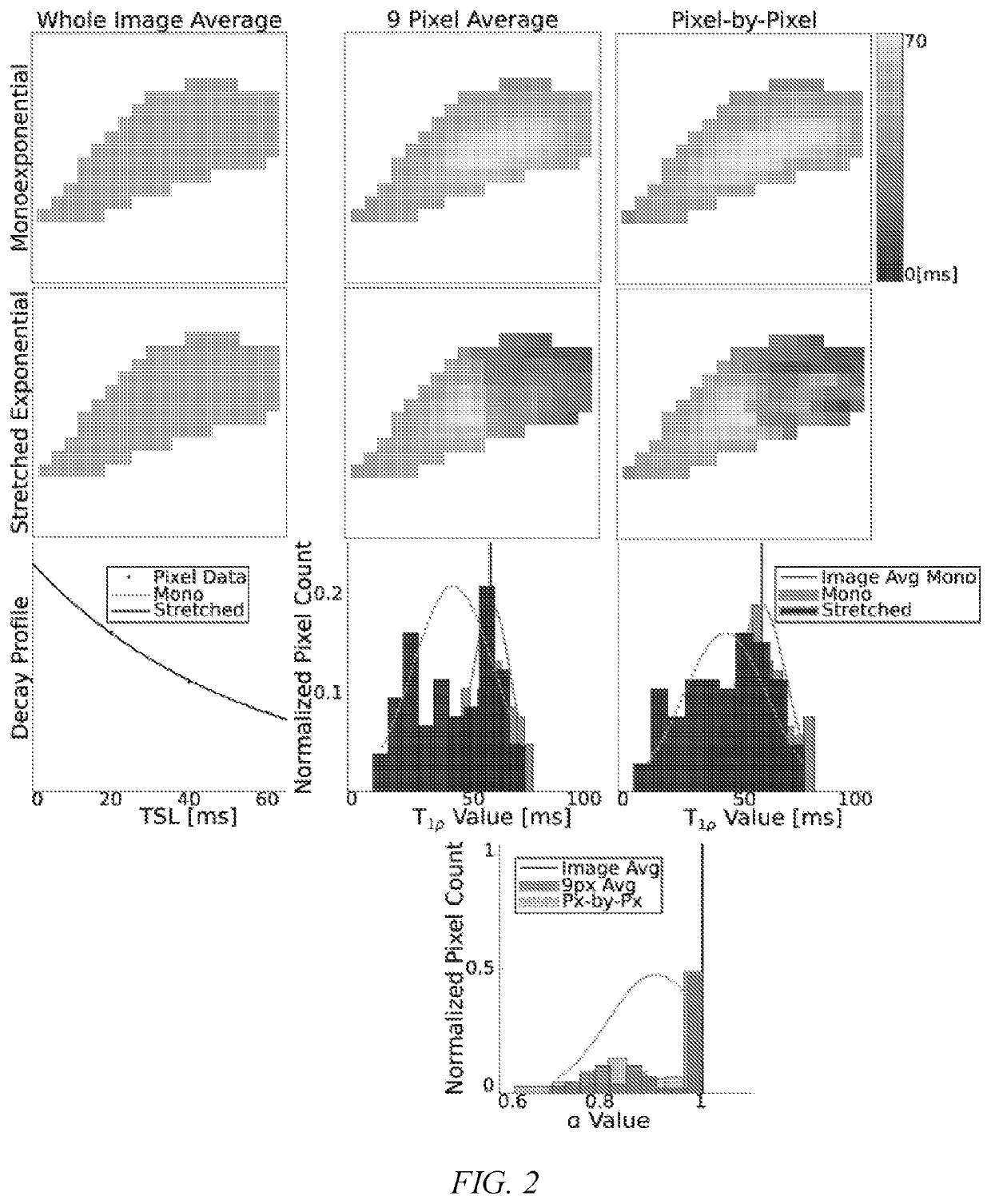 Soft tissue matrix characterization using stretched exponential relaxation modeling