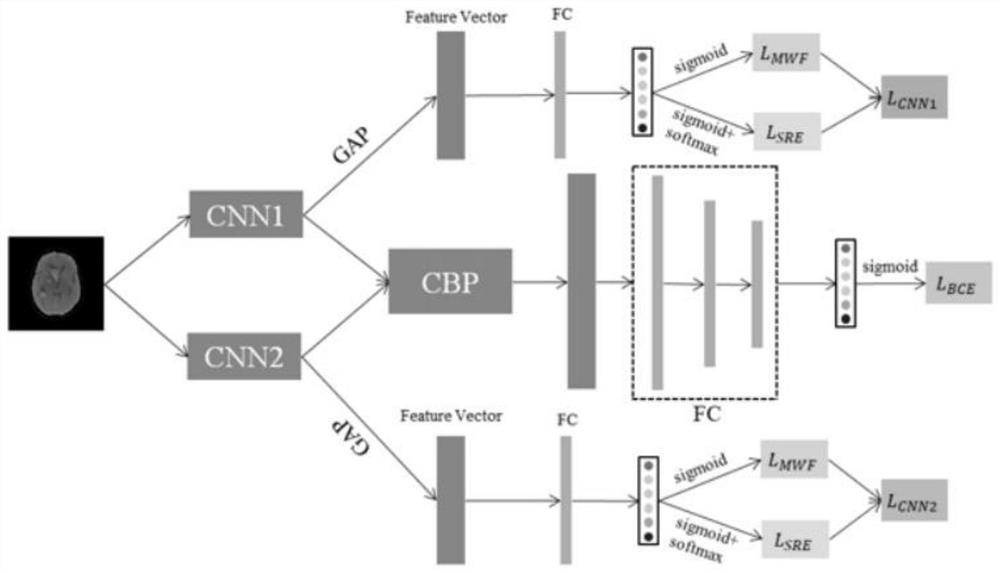 Intracranial hemorrhage subtype classification algorithm based on bilinear pooling applied to CT images