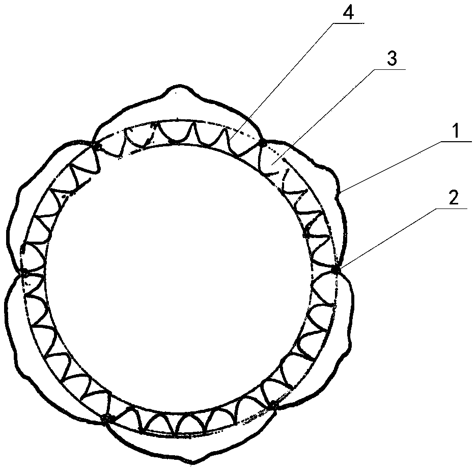 Ascending aorta covered stent released by transapical approach