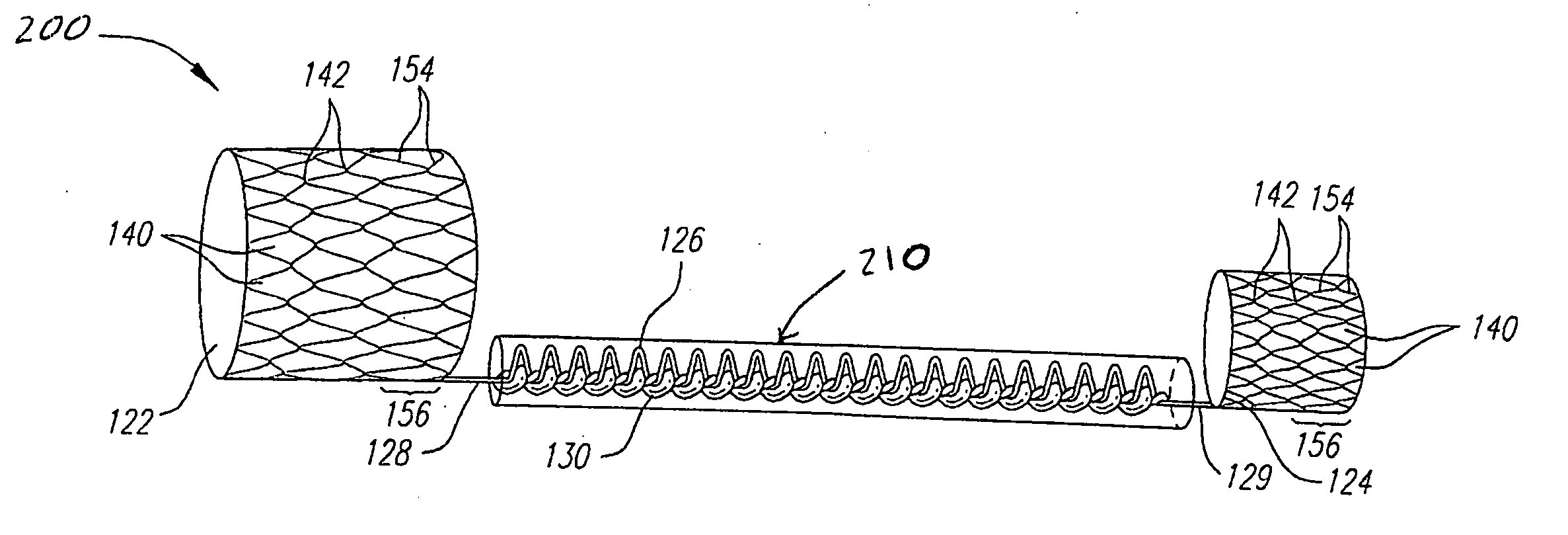 Medical implant with reinforcement mechanism