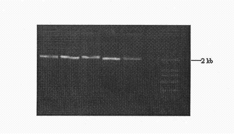 Sequencing-based typing method of human leucocyte antigen (HLA)-Cw gene