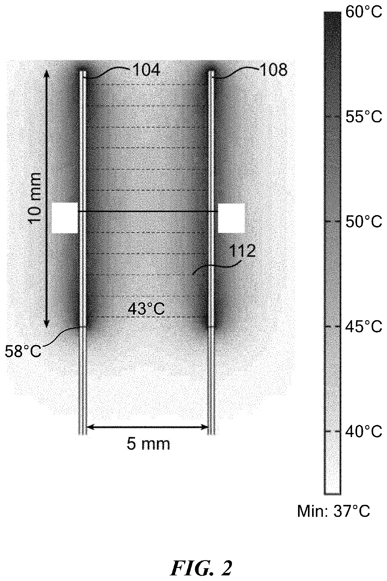 Device and method for treating tissue