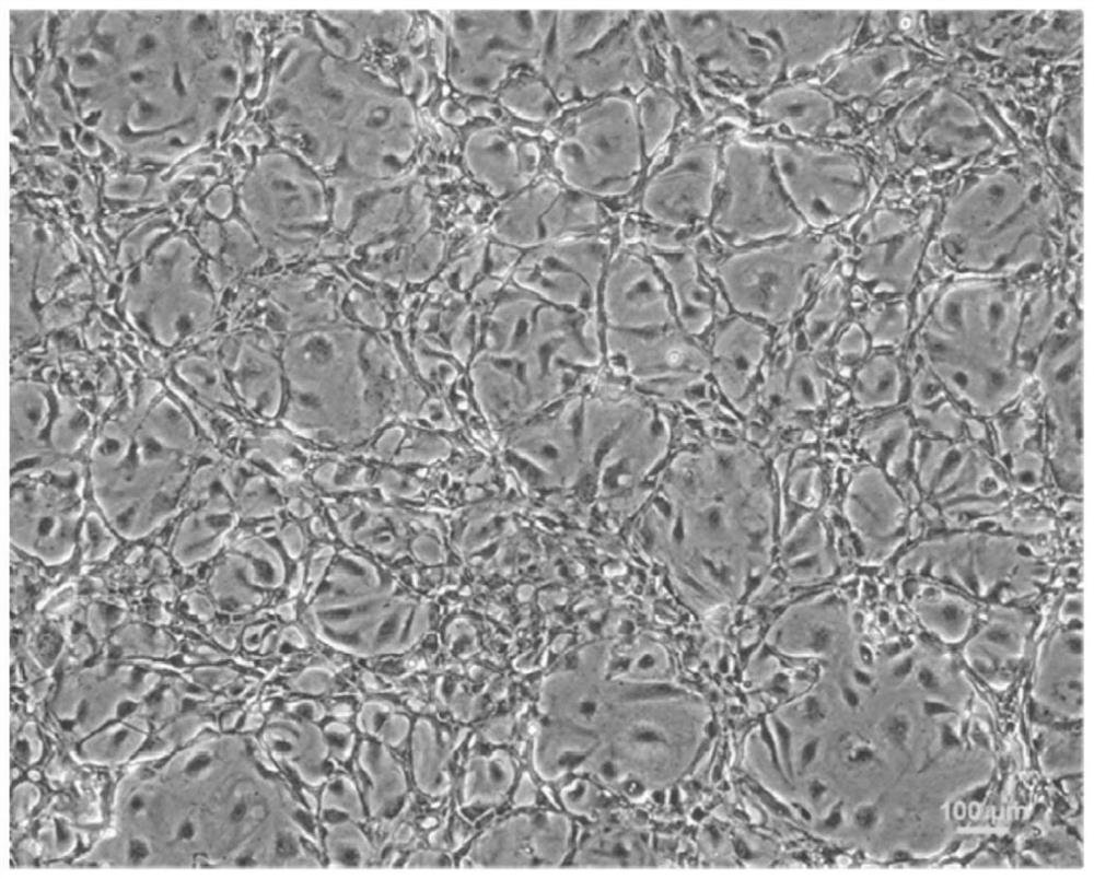 Endothelial and smooth muscle-like tissues produced from urine cells and related uses thereof