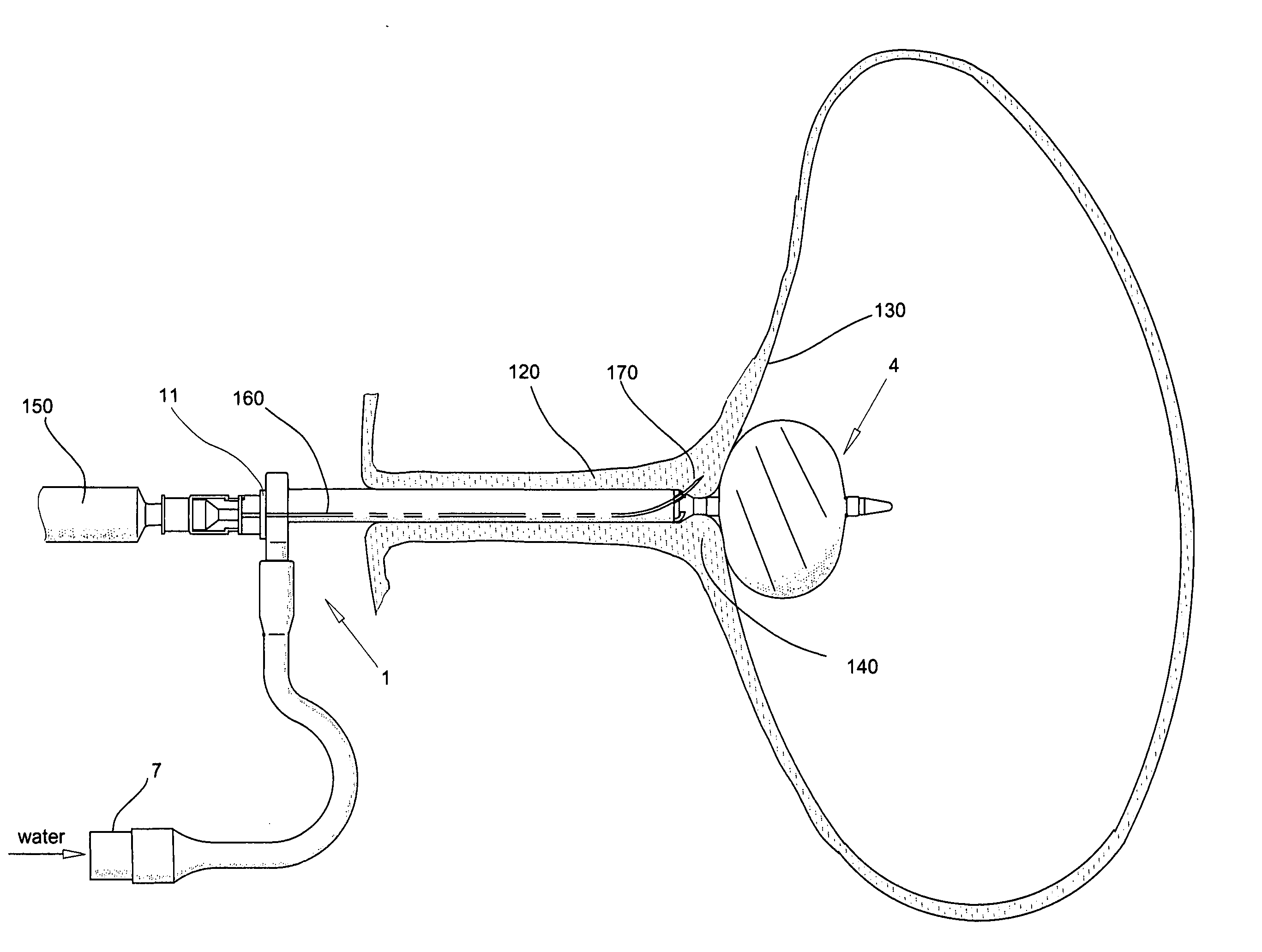 Instrument used in treatment of the urinary incontinence in women