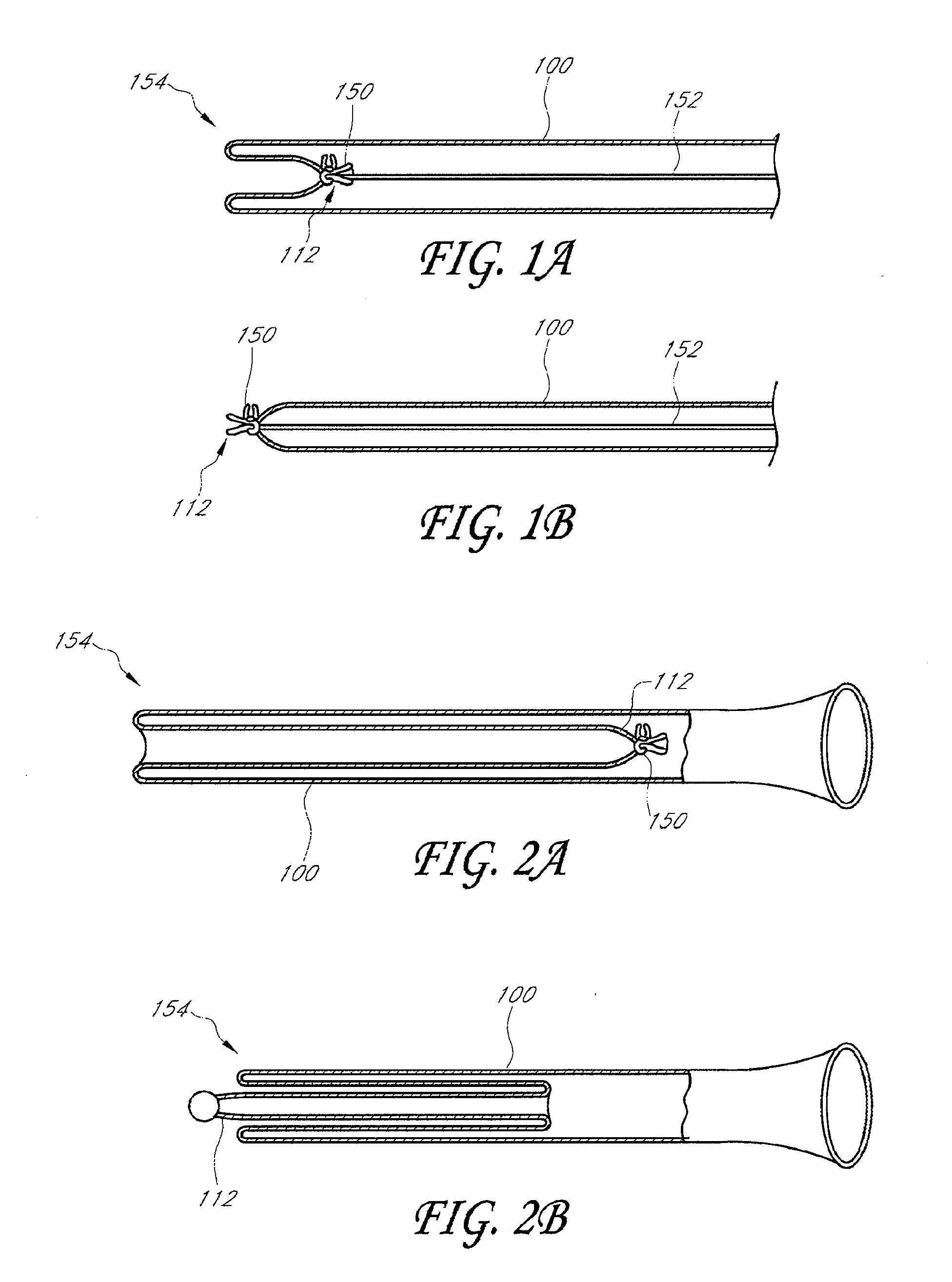 Methods for toposcopic sleeve delivery