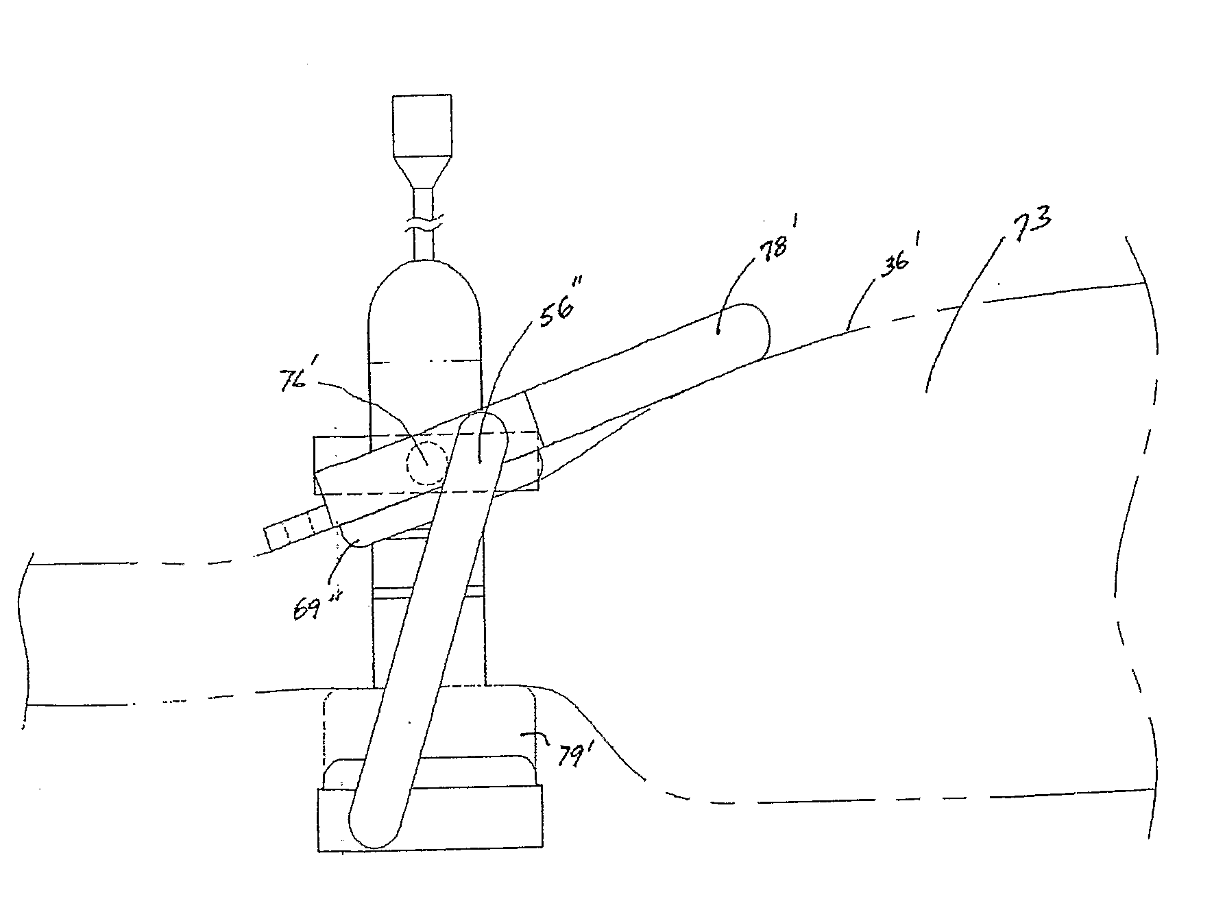 Clamp Device to Plicate the Stomach