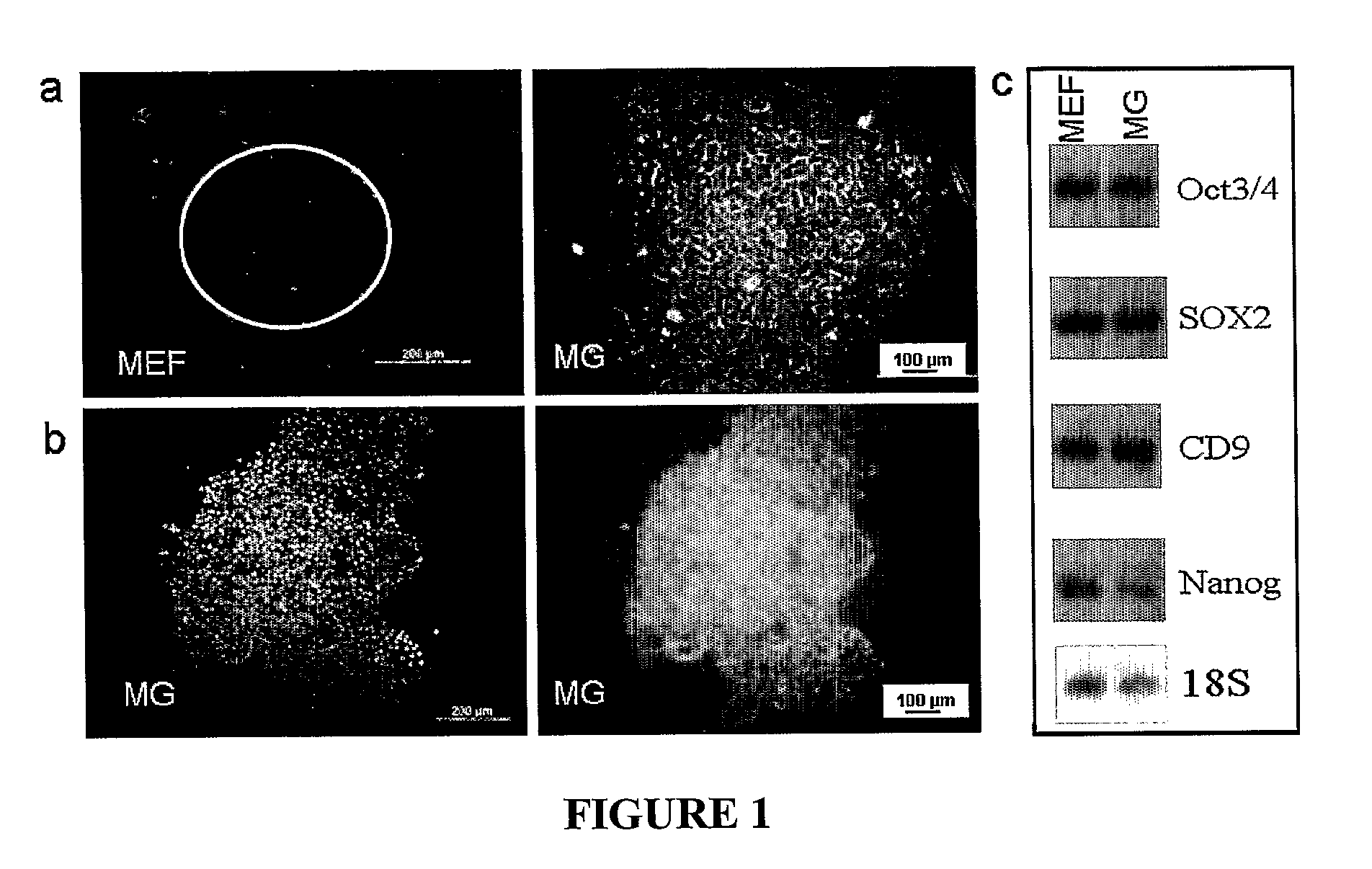 Method for differentiating embryonic stem cells into cells expressing aqp-1