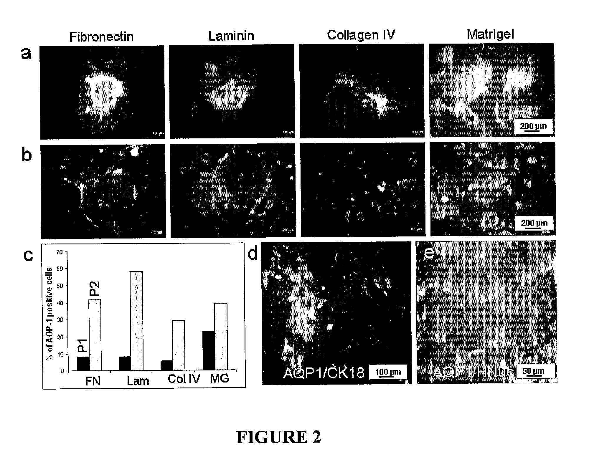 Method for differentiating embryonic stem cells into cells expressing aqp-1