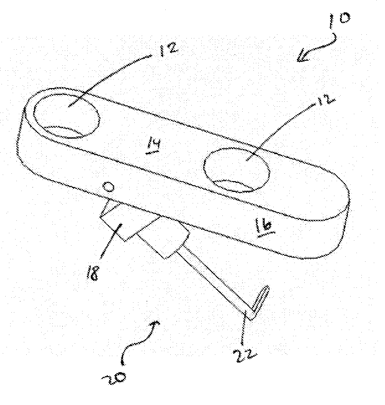 Devices for use in Transluminal and Endoluminal Surgery