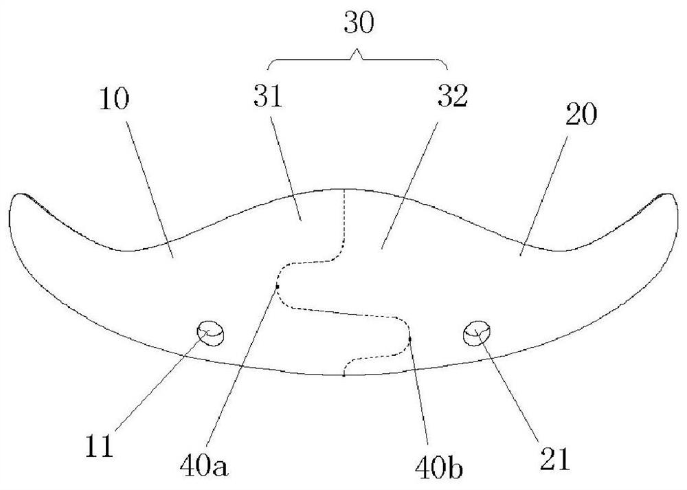 Chin implant with split embedded structure