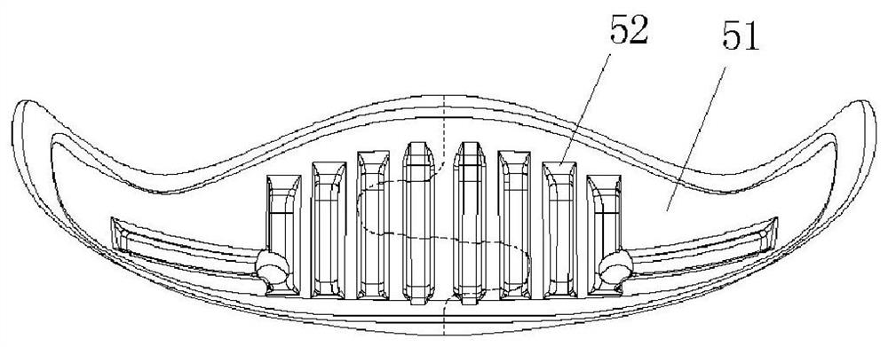 Chin implant with split embedded structure