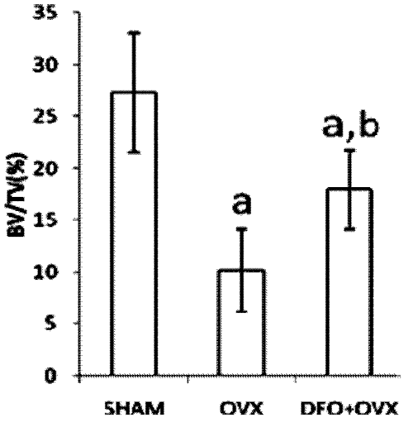 Application of deferoxamine mesylate in preparing medicaments for treating postmenopausal osteoporosis