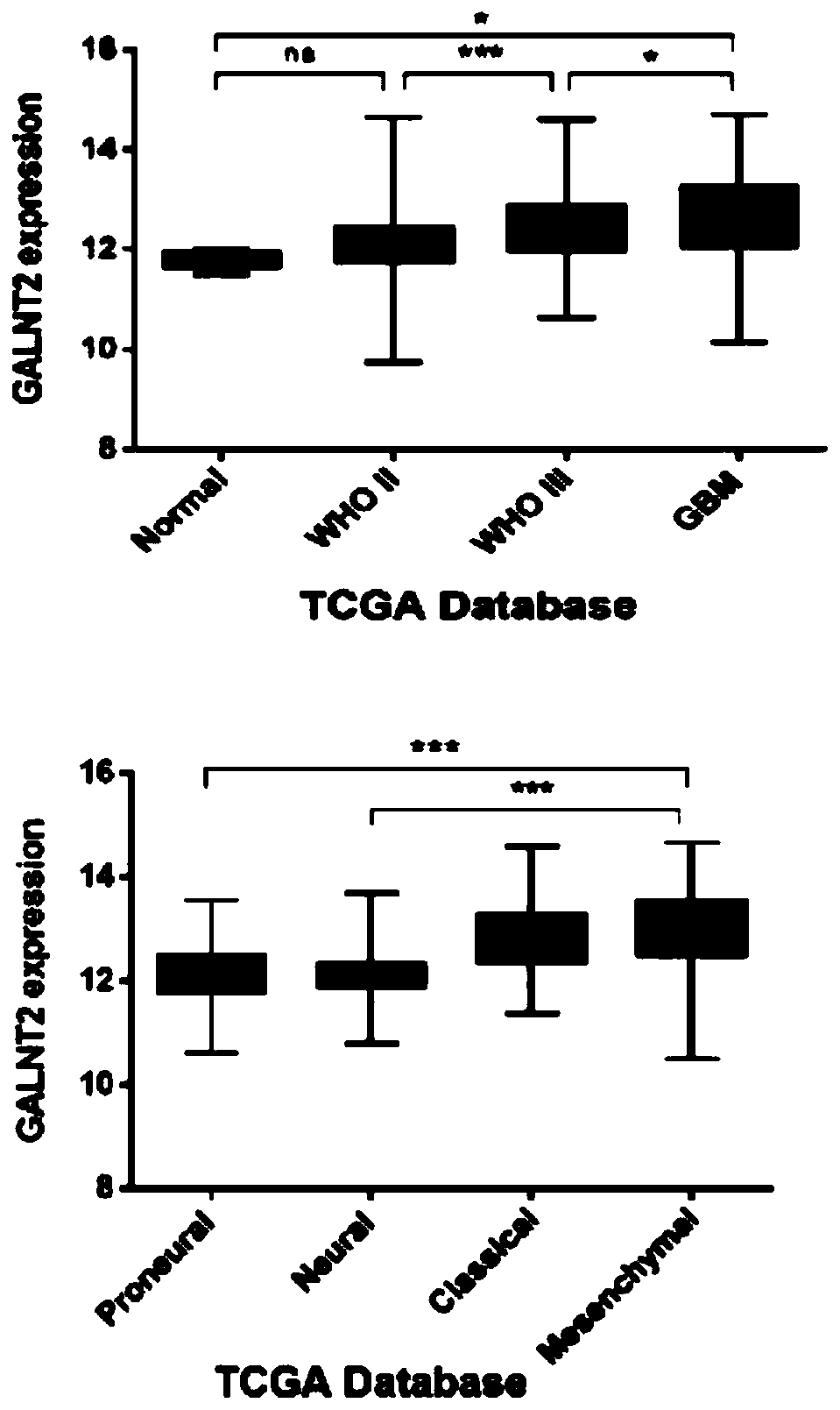 Use of galnt2 as a biomarker in the diagnosis and/or treatment of glioma