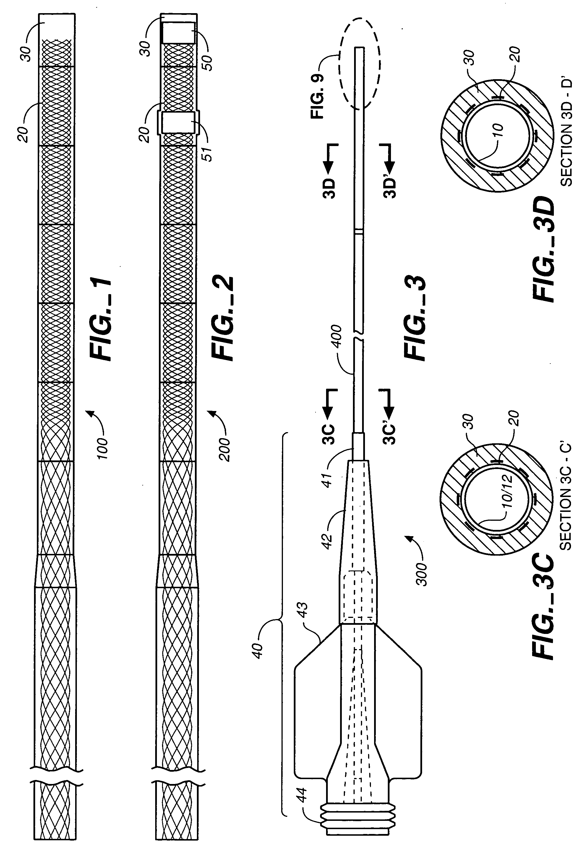 Wire braid-reinforced microcatheter