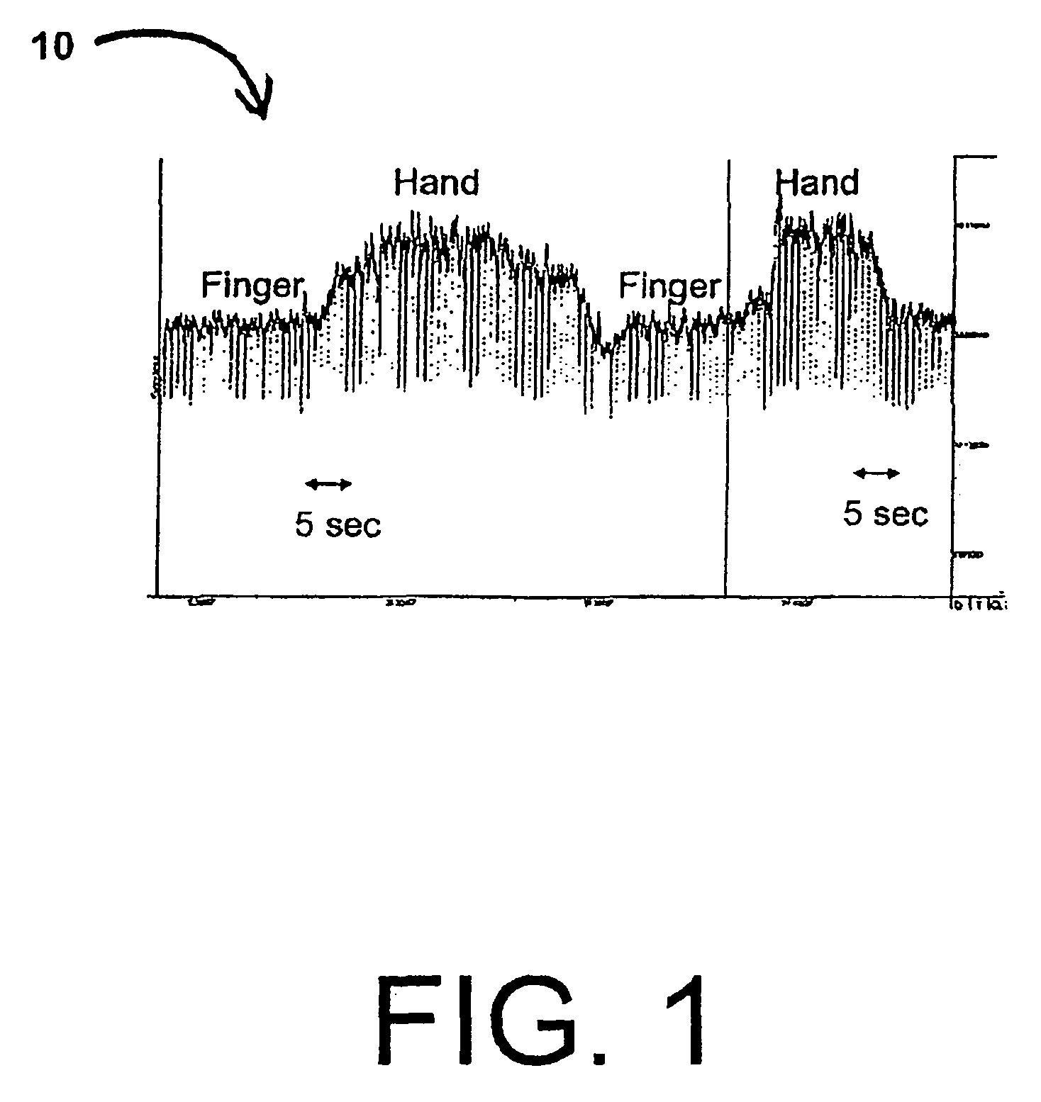 Systems and methods for epicardial navigation