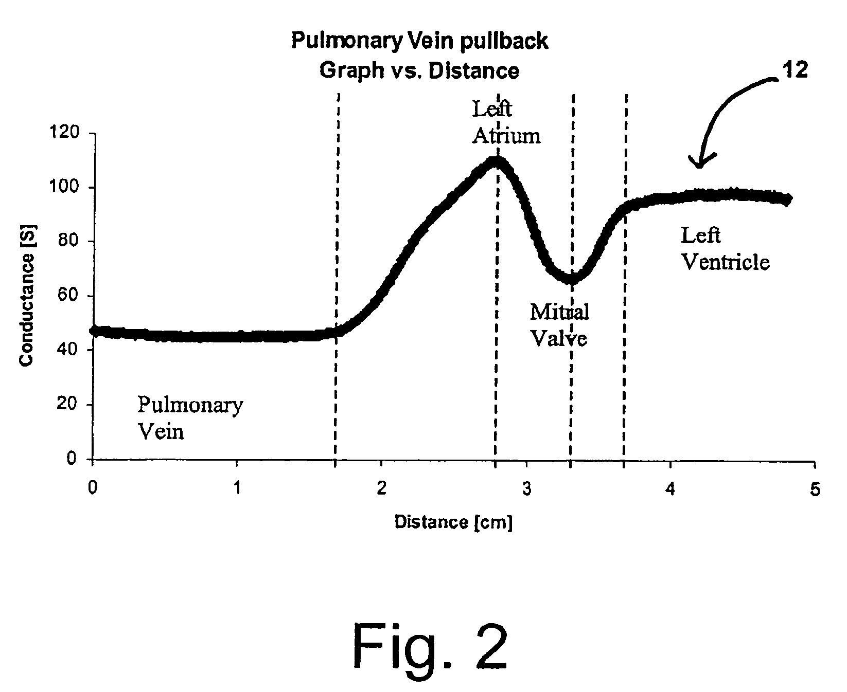 Systems and methods for epicardial navigation