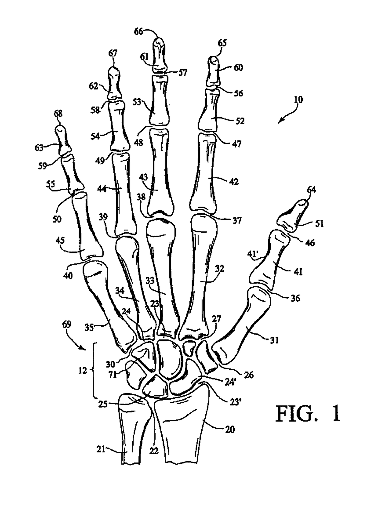 Multi-purpose glove