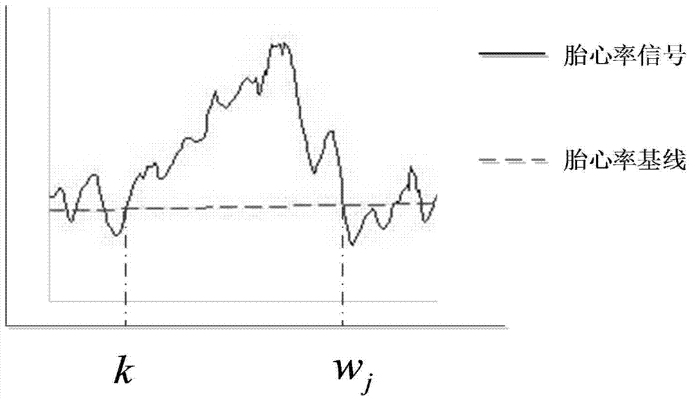 A Method for Extracting Acceleration Characteristic Parameters of Fetal Heart Monitoring