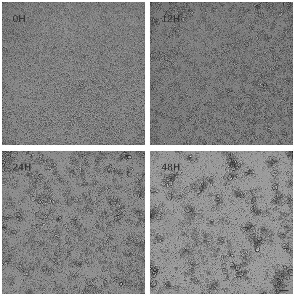 Lung cancer micro-tumor cell model culture method