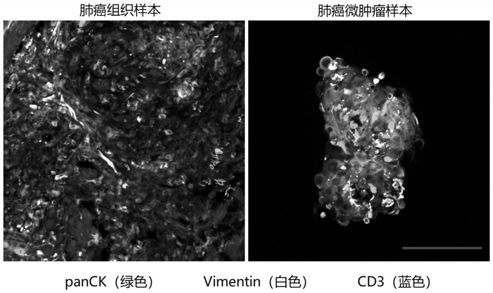 Lung cancer micro-tumor cell model culture method