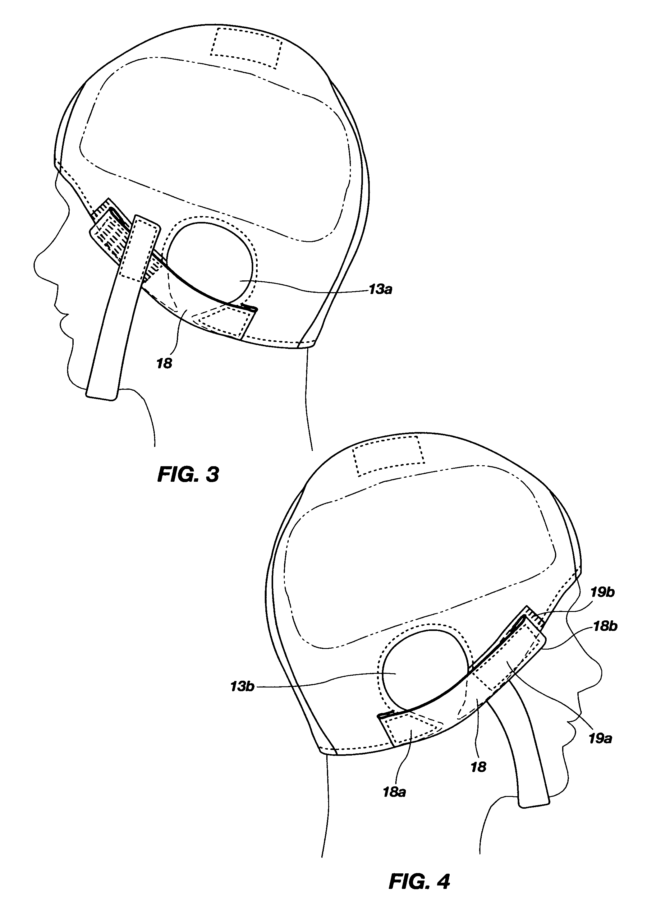 Helmet trauma bandage and method