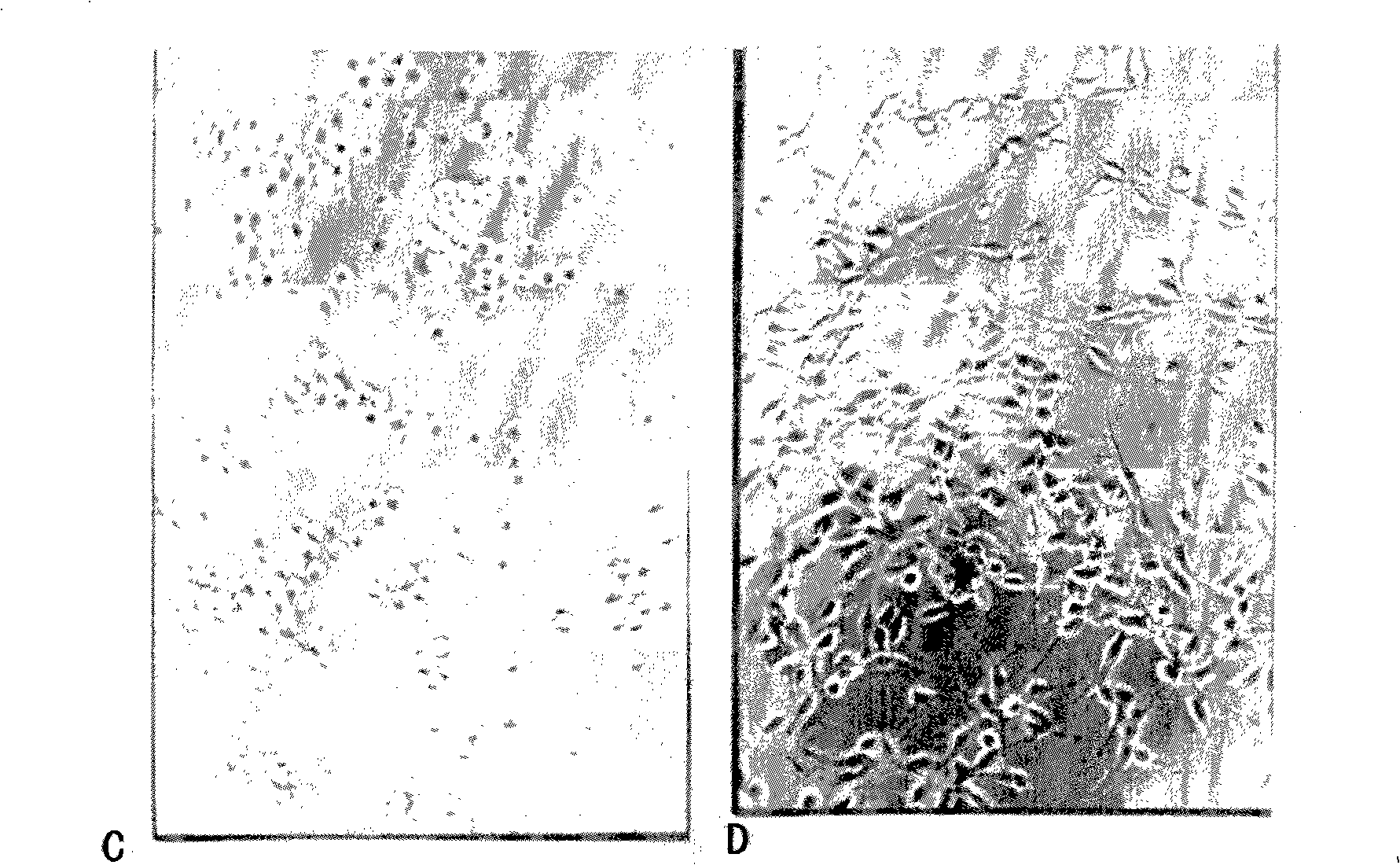 Medicine for treating nerves damage and preparation method thereof